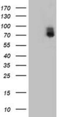 Western Blot: ILVBL Antibody (OTI8B12) - Azide and BSA Free [NBP2-71661] - HEK293T cells were transfected with the pCMV6-ENTRY control (Left lane) or pCMV6-ENTRY ILVBL (Right lane) cDNA for 48 hrs and lysed. Equivalent amounts of cell lysates (5 ug per lane) were separated by SDS-PAGE and immunoblotted with anti-ILVBL.