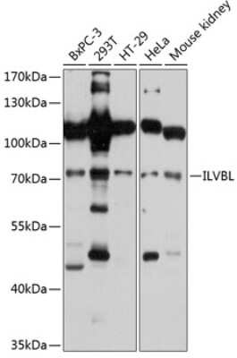 Western Blot: ILVBL Antibody [NBP3-05076] - Analysis of extracts of various cell lines, using ILVBL antibody at 1:3000 dilution. Secondary antibody: HRP Goat Anti-Rabbit IgG (H+L) at 1:10000 dilution. Lysates/proteins: 25ug per lane. Blocking buffer: 3% nonfat dry milk in TBST. Detection: ECL Basic Kit