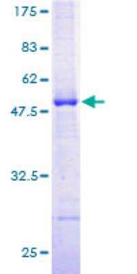 SDS-Page: ILVBL Recombinant Protein [H00010994-P01]