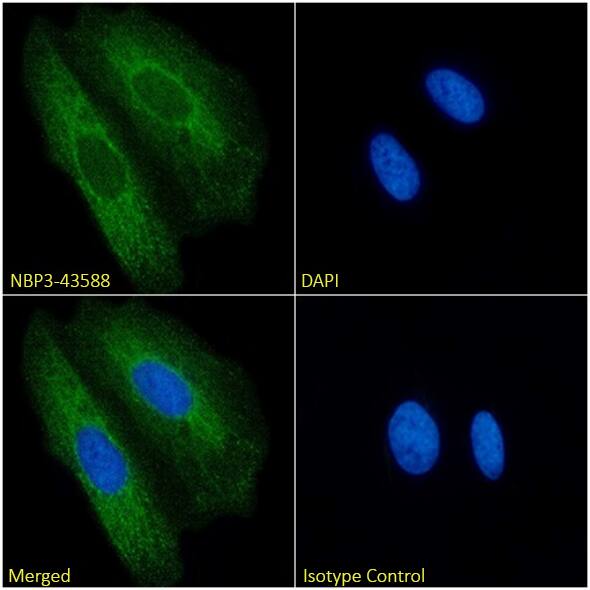 Immunocytochemistry/ Immunofluorescence: Cytokeratin 8/18 Antibody (COU-1) - Chimeric - BSA Free [NBP3-43588] - Immunofluorescence analysis of paraformaldehyde fixed HeLa cells, permeabilized with 0.15% Triton, on coverslips stained with NBP3-43588 (1:100 dilution) for 1h followed by Alexa Fluor® 488 secondary antibody (1:1000 dilution), showing cytoplasmic staining. The nuclear stain is DAPI (blue). Panels show, from left-right, top-bottom, NBP3-43588, DAPI, merged channels, and an isotype control. The isotype control was an unknown specificity antibody followed by staining with Alexa Fluor® 488 secondary antibody.