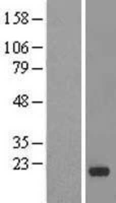 Western Blot: IMMP1L Overexpression Lysate (Adult Normal) [NBL1-11978] Left-Empty vector transfected control cell lysate (HEK293 cell lysate); Right -Over-expression Lysate for IMMP1L.
