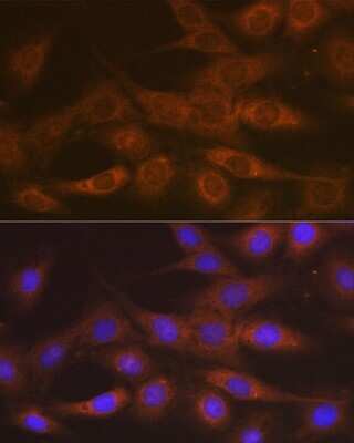 Immunocytochemistry/Immunofluorescence: IMP Dehydrogenase 2/IMPDH2 Antibody (4X3S10) [NBP3-16786] - Immunofluorescence analysis of C6 cells using IMP Dehydrogenase 2/IMPDH2 Rabbit mAb (NBP3-16786) at dilution of 1:100 (40x lens). Blue: DAPI for nuclear staining.