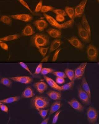 Immunocytochemistry/Immunofluorescence: IMP Dehydrogenase 2/IMPDH2 Antibody (4X3S10) [NBP3-16786] - Immunofluorescence analysis of NIH-3T3 cells using IMP Dehydrogenase 2/IMPDH2 Rabbit mAb (NBP3-16786) at dilution of 1:100 (40x lens). Blue: DAPI for nuclear staining.