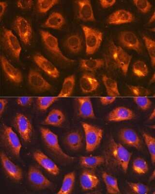 Immunocytochemistry/Immunofluorescence: IMP Dehydrogenase 2/IMPDH2 Antibody (4X3S10) [NBP3-16786] - Immunofluorescence analysis of U-2 OS cells using IMP Dehydrogenase 2/IMPDH2 Rabbit mAb (NBP3-16786) at dilution of 1:100 (40x lens). Blue: DAPI for nuclear staining.