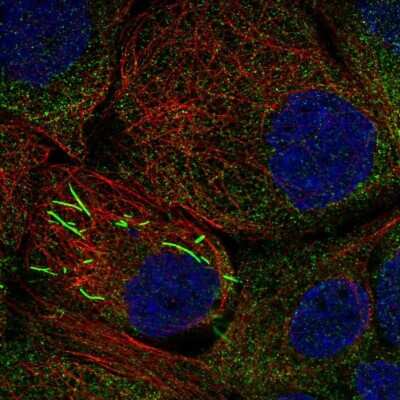 <b>Genetic Strategies Validation. </b>Immunocytochemistry/Immunofluorescence: IMP Dehydrogenase 2/IMPDH2 Antibody [NBP1-86177] - Staining of human cell line A-431 shows localization to cytosol & rods & rings.