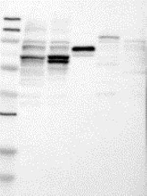 Western Blot: IMP2/IGF2BP2 Antibody [23750002] - Samples:   Lane 1, Marker [kDa]: 250, 130, 95, 72, 55, 36, 28, 17, 11  Lane 2, RT-4 Lane 3, U-251MG sp Lane 4, Human Plasma Lane 5, Liver Lane 6, Tonsil       Target weight [kDa]:   66, 62 (splice variants)        Validation score:   2   Validation description:   Supportive - Band of predicted size in kDa (+/-20%) with additional bands present.