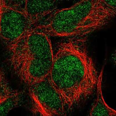 Immunocytochemistry/Immunofluorescence: IMP3 Antibody [NBP2-56441] - Staining of human cell line HEK 293 shows localization to nucleus & nucleoli.