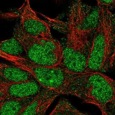 Immunocytochemistry/Immunofluorescence: IMP3 Antibody [NBP2-56774] - Staining of human cell line HEK 293 shows localization to nucleus & nucleoli.