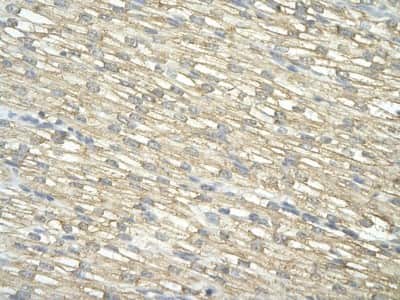 Immunohistochemistry: IMP3 Antibody [NBP1-57229] - Human Heart cell Cellular data: cardiac cell Antibody Concentration: 4.0-8.0 ug/ml Magnification: 400X.