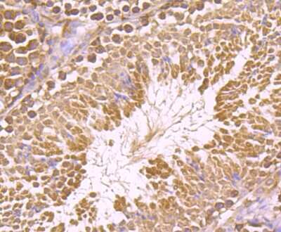 Immunohistochemistry-Paraffin: IMP3 Antibody [NBP2-75542] - Analysis of paraffin-embedded mouse testis tissue using anti-IMP-3 antibody. Counter stained with hematoxylin.