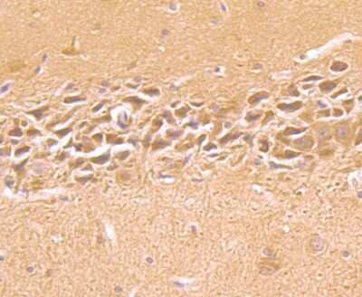 Immunohistochemistry-Paraffin: IMP3 Antibody [NBP2-75542] - Analysis of paraffin-embedded rat brain tissue using anti-IMP-3 antibody. Counter stained with hematoxylin.