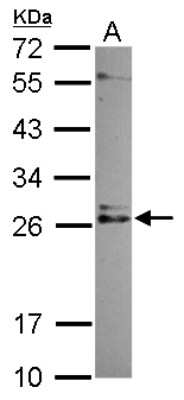 Western Blot: IMP3 Antibody [NBP2-16961] - Sample (30 ug of whole cell lysate) A: NT2D1 12% SDS PAGE gel, diluted at 1:500.
