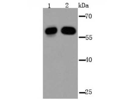Western Blot: IMP3 Antibody [NBP2-75542] - Analysis of IMP-3 on Hela (1) and 293T (2) cell lysate using anti-IMP-3 antibody at 1/2,000 dilution.