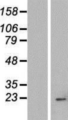 Western Blot IMP3 Overexpression Lysate