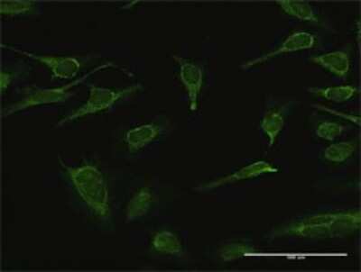 Immunocytochemistry/Immunofluorescence: IMPA1 Antibody [H00003612-D01P] - Analysis of antibody to IMPA1 on HeLa cell. Antibody concentration 10 ug/ml.