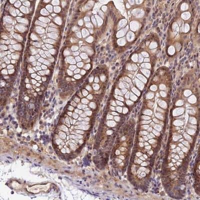 Immunohistochemistry-Paraffin: IMPACT Antibody [NBP1-86234] - Staining of human colon shows moderate cytoplasmic and nuclear positivity in glandular cells.