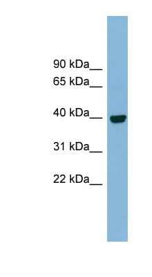 Western Blot: IMPAD1 Antibody [NBP1-59473] - Human Spleen lysate, concentration 0.2-1 ug/ml.