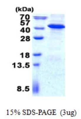SDS-PAGE Recombinant Human Inositol Monophosphatase 3/IMPAD1 His Protein