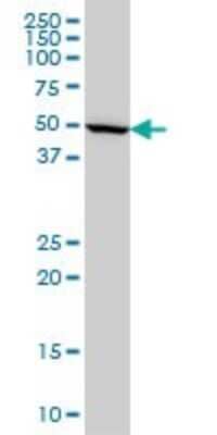 Western Blot: IMPDH1 Antibody (3G6) [H00003614-M01] - IMPDH1 monoclonal antibody (M01), clone 3G6 Analysis of IMPDH1 expression in Hela S3 NE.