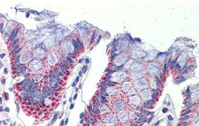 Immunohistochemistry-Paraffin: IMPDH1 Antibody [NBP1-52933] - Human Colon Tissue, antibody concentration 5 ug/ml.