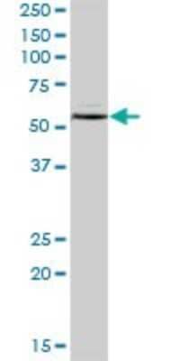 Western Blot: IMPDH1 Antibody [H00003614-B01P] - Analysis of IMPDH1 expression in human spleen.