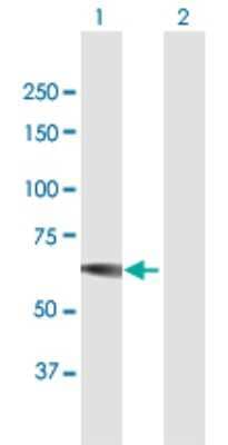 Western Blot: IMPDH1 Antibody [H00003614-B01P] - Analysis of IMPDH1 expression in transfected 293T cell line by IMPDH1 polyclonal antibody.  Lane1:IMPDH1 transfected lysate(61.93 KDa). Lane2:Non-transfected lysate.