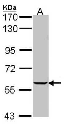 Western Blot: IMPDH1 Antibody [NBP1-32854] - Sample (30 ug of whole cell lysate) A: Raji 7. 5% SDS PAGE; antibody diluted at 1:1000.