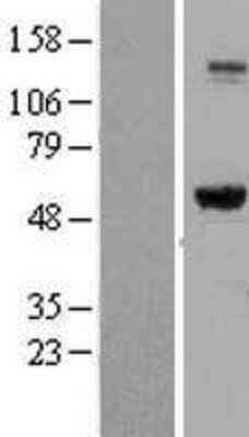 Western Blot: IMPDH2 Overexpression Lysate (Adult Normal) [NBL1-11987] Left-Empty vector transfected control cell lysate (HEK293 cell lysate); Right -Over-expression Lysate for IMPDH2.