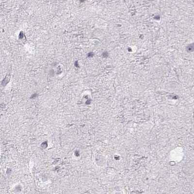 Immunohistochemistry-Paraffin: IMPG1 Antibody [NBP2-55575] - Staining of human cerebral cortex.