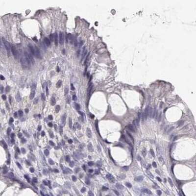 Immunohistochemistry-Paraffin: IMPG1 Antibody [NBP2-55575] - Staining of human colon.