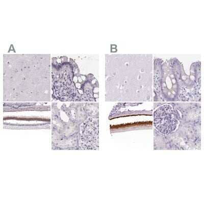 Immunohistochemistry-Paraffin: IMPG1 Antibody [NBP2-55575] - Staining of human cerebral cortex, colon, eye, retina and kidney using Anti-IMPG1 antibody NBP2-55575 (A) shows similar protein distribution across tissues to independent antibody NBP2-57460 (B).