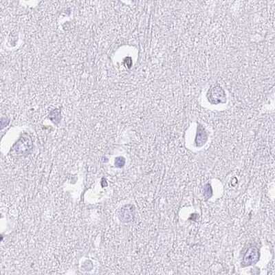 Immunohistochemistry-Paraffin IMPG1 Antibody