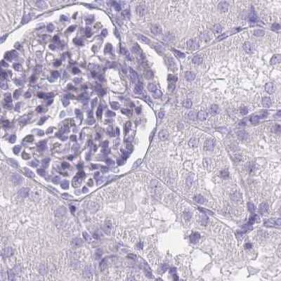 Immunohistochemistry-Paraffin IMPG1 Antibody