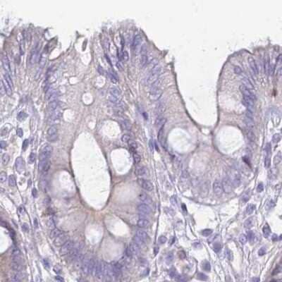 Immunohistochemistry-Paraffin IMPG1 Antibody