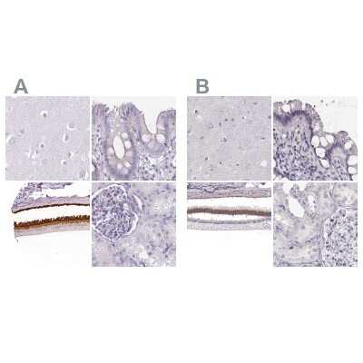 Immunohistochemistry-Paraffin: IMPG1 Antibody [NBP2-57460] - Staining of human cerebral cortex, colon, eye, retina and kidney using Anti-IMPG1 antibody NBP2-57460 (A) shows similar protein distribution across tissues to independent antibody NBP2-55575 (B).