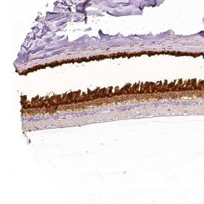 Immunohistochemistry-Paraffin: IMPG1 Antibody [NBP2-57460] - Staining of human eye, retina.