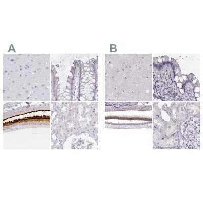 <b>Independent Antibodies Validation. </b>Immunohistochemistry-Paraffin: IMPG1 Antibody [NBP2-57461] - Staining of human cerebral cortex, colon, eye, retina and kidney using Anti-IMPG1 antibody NBP2-57461 (A) shows similar protein distribution across tissues to independent antibody NBP2-55575 (B).