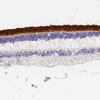 Immunohistochemistry-Paraffin IMPG2 Antibody