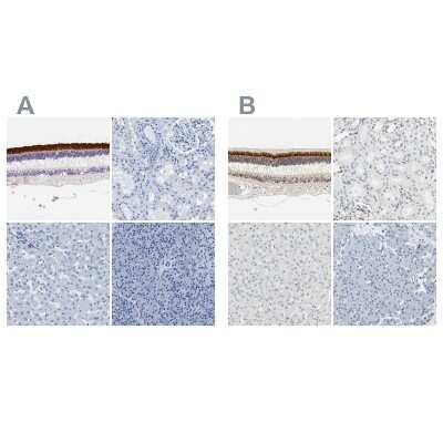 Immunohistochemistry-Paraffin IMPG2 Antibody