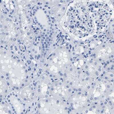 Immunohistochemistry-Paraffin IMPG2 Antibody