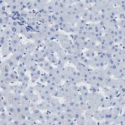 Immunohistochemistry-Paraffin: IMPG2 Antibody [NBP2-54954] - Staining of human liver shows no positivity in hepatocytes as expected.