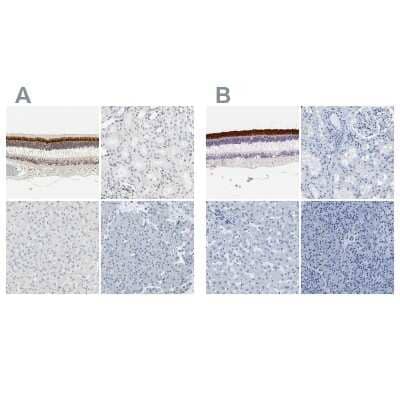 Immunohistochemistry-Paraffin: IMPG2 Antibody [NBP2-58919] - Staining of human eye, retina, kidney, liver and pancreas using Anti-IMPG2 antibody NBP2-58919 (A) shows similar protein distribution across tissues to independent antibody NBP2-54954 (B).
