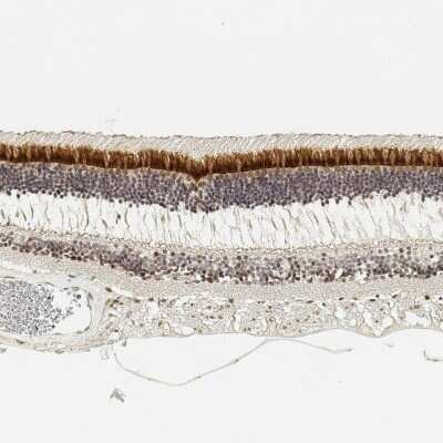 <b>Independent Antibodies Validation. </b>Immunohistochemistry-Paraffin: IMPG2 Antibody [NBP2-58919] - Staining of human retina shows strong cytoplasmic positivity in rodes and cones cells.