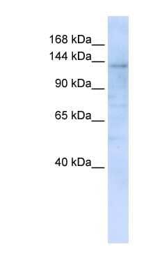 Western Blot: IMPG2 Antibody [NBP1-62656] - 293T cells lysate, concentration 0.2-1 ug/ml.