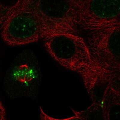 Immunocytochemistry/Immunofluorescence: INCENP Antibody [NBP2-57266] - Staining of human cell line MCF7 shows localization to nucleus & midbody.