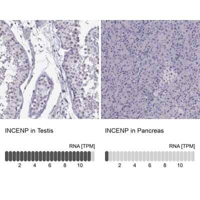 <b>Orthogonal Strategies Validation. </b>Immunohistochemistry-Paraffin: INCENP Antibody [NBP2-62620] - Immunohistochemistry analysis in human testis and pancreas tissues using Anti-INCENP antibody. Corresponding INCENP RNA-seq data are presented for the same tissues.