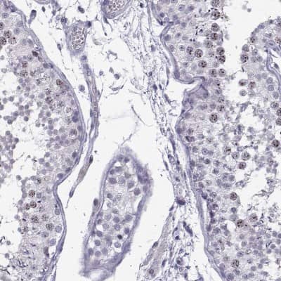 Immunohistochemistry-Paraffin: INCENP Antibody [NBP2-62620] - Staining of human testis shows high expression.