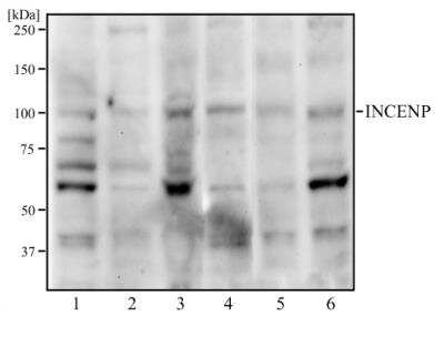 Western Blot: INCENP Antibody [NB100-2286] - Western blot analysis of HeLa (1), A431 (2), MCF7 (3), HEK293 (4), Neuro2a (5), and Raw 264.7 (6) cell lysate using INCENP antibody at a concentration of 2 ug/ml.