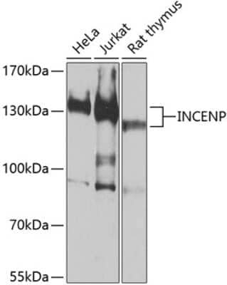 Western Blot: INCENP Antibody [NBP3-05157] - Analysis of extracts of various cell lines, using INCENP antibody at 1:1000 dilution. Secondary antibody: HRP Goat Anti-Rabbit IgG (H+L) at 1:10000 dilution. Lysates/proteins: 25ug per lane. Blocking buffer: 3% nonfat dry milk in TBST. Detection: ECL Basic Kit