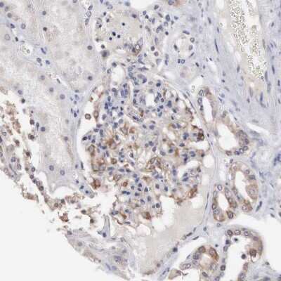 Immunohistochemistry-Paraffin INF2 Antibody - BSA Free